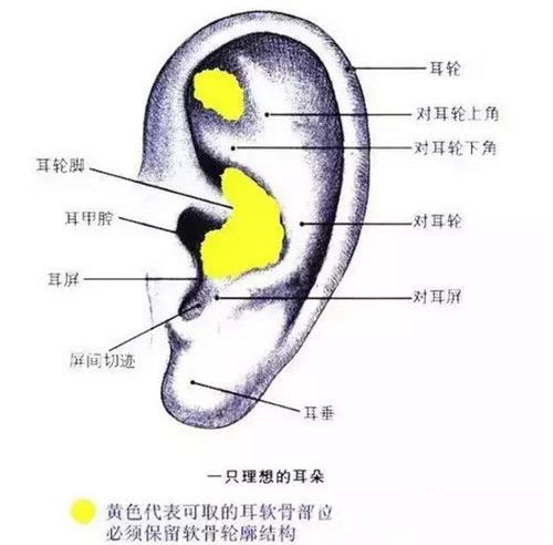 耳软骨垫鼻尖三个月，恢复、变化与体验