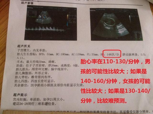 揭秘性别之谜，8个月B超预测男却生下女